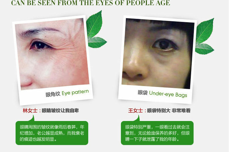 眼纹消 可贝儿的眼纹消