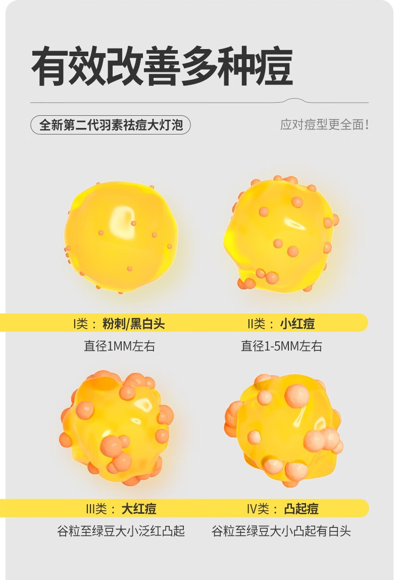 羽素羽素祛痘大灯泡精华液快速瘪痘褪红去闭口粉刺舒缓控油改善痘肌 17.5%二代胶态硫5ml+随身礼盒