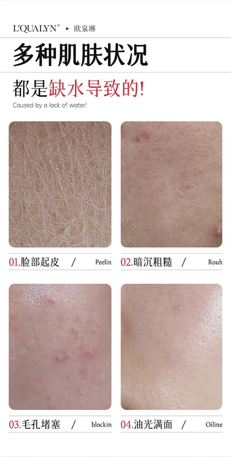 歐泉琳（LQUALYN）烟酰胺马来西亚甘油护肤精华水脸部精华液暗沉补水保湿女全身可用 红色 140ml
