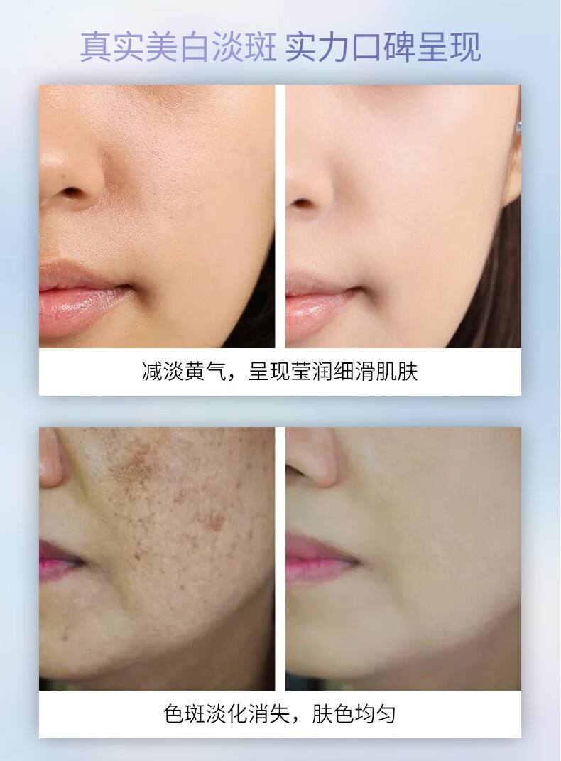 日出倾城北京同仁堂美白淡斑精华液30ml 精华淡化面部精华烟酰胺护肤美白 1瓶装