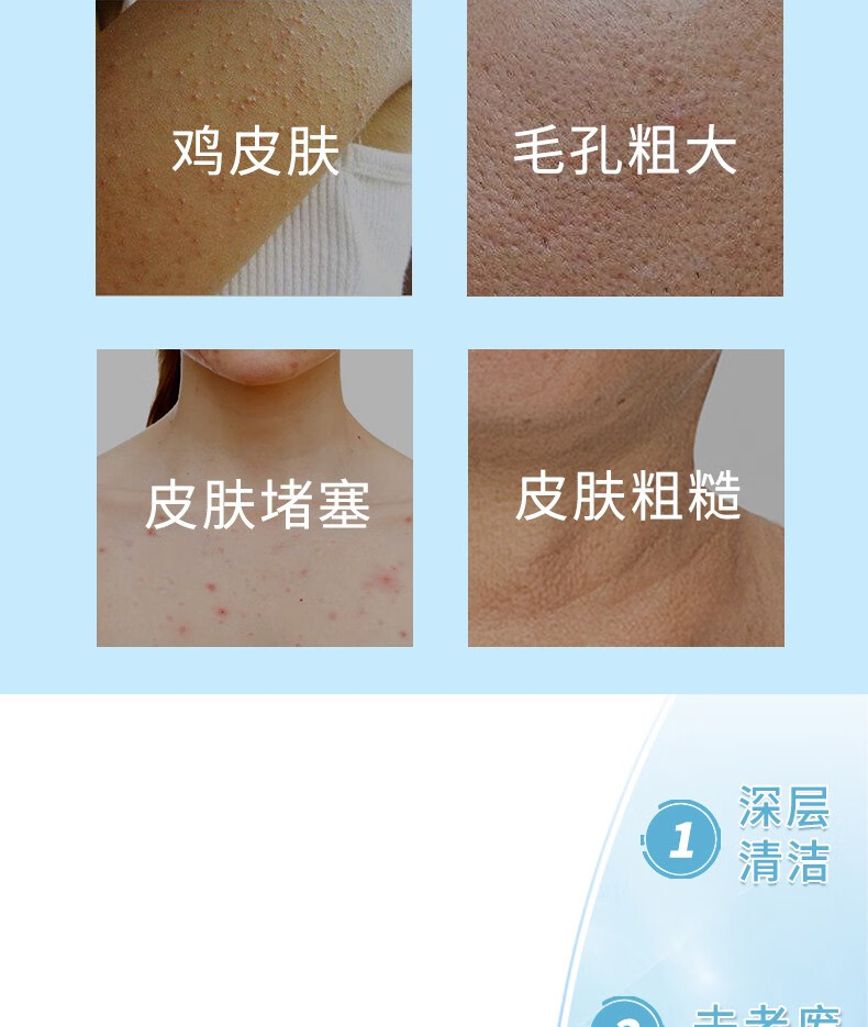 STRIDEX美国进口施颜适水杨酸棉片清洁毛孔角质痘痘闭口粉刺黑头净痘印 蓝色进阶型1.0%