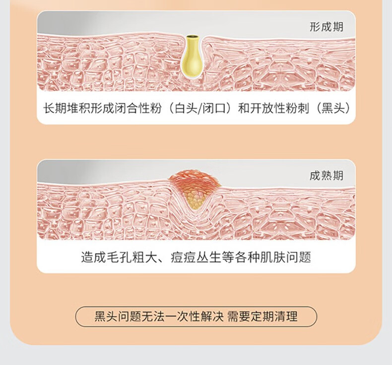 李医生（DOCTOR LI） 备长炭吸附去黑头撕拉面膜150g深层清洁女收缩毛孔白头鼻贴膜男