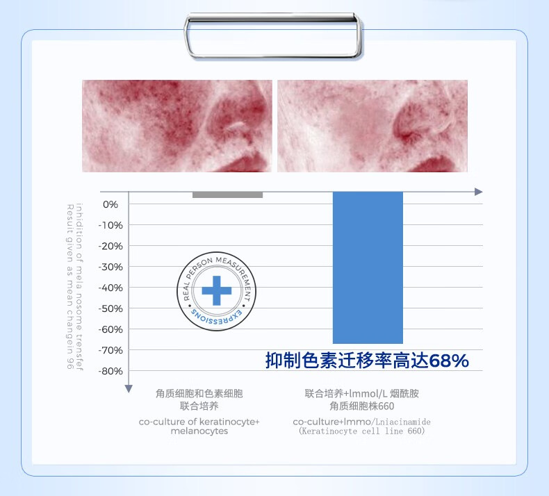 EXPRESSIONS爱碧生进口祛痘印痘坑修复啫喱淡化消印去痘痘膏红肿痘疤女男士 【小样】祛痘啫喱15g