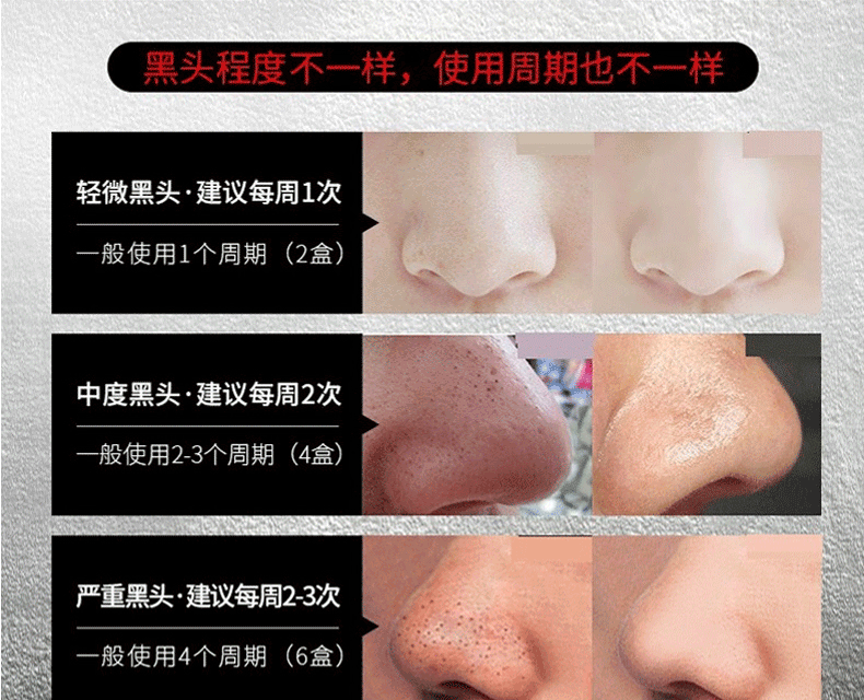 诗妃 男士黑头鼻贴吸鼻子黑头撕拉式黑鼻头贴鼻膜清洁毛孔男生草莓鼻 黑头鼻贴21片