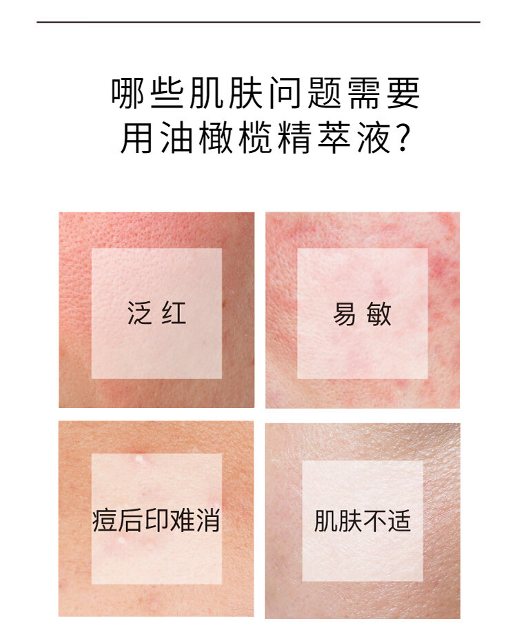 John Jeff 油橄榄面部精华液舒缓肌肤维稳刷修护控油淡化痘印男女护肤品 15mL