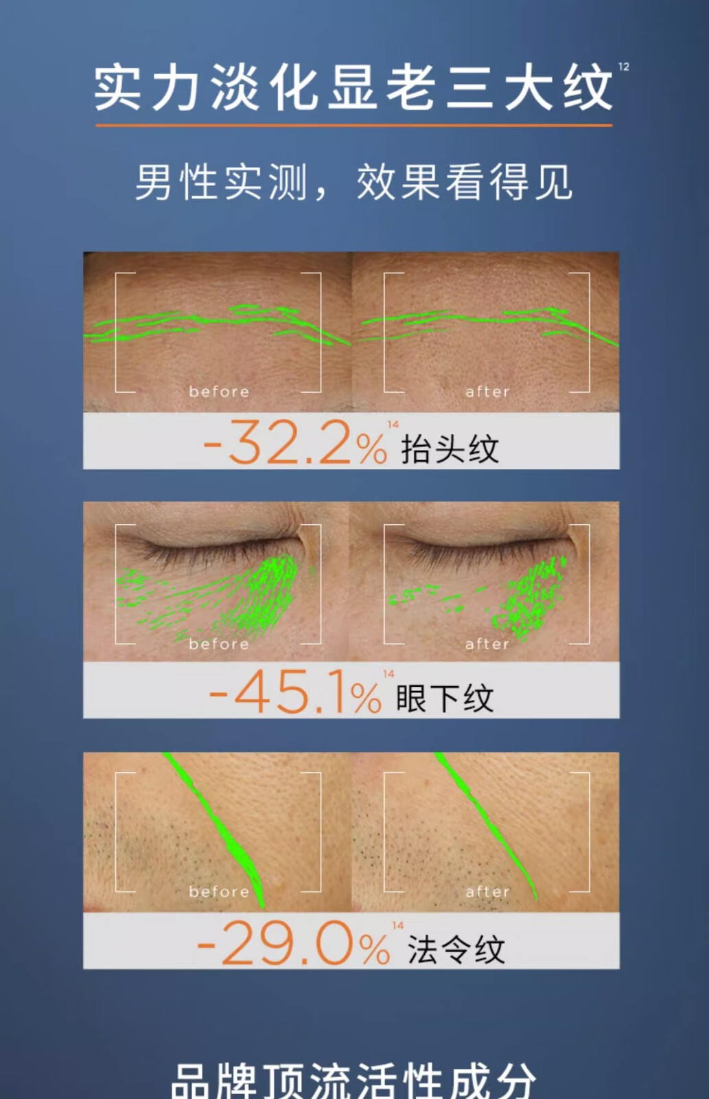 欧莱雅男士套装面霜精华眼霜护肤品抗皱青春肌源紧致亮肤控油保湿 紧致精华乳15ml*4