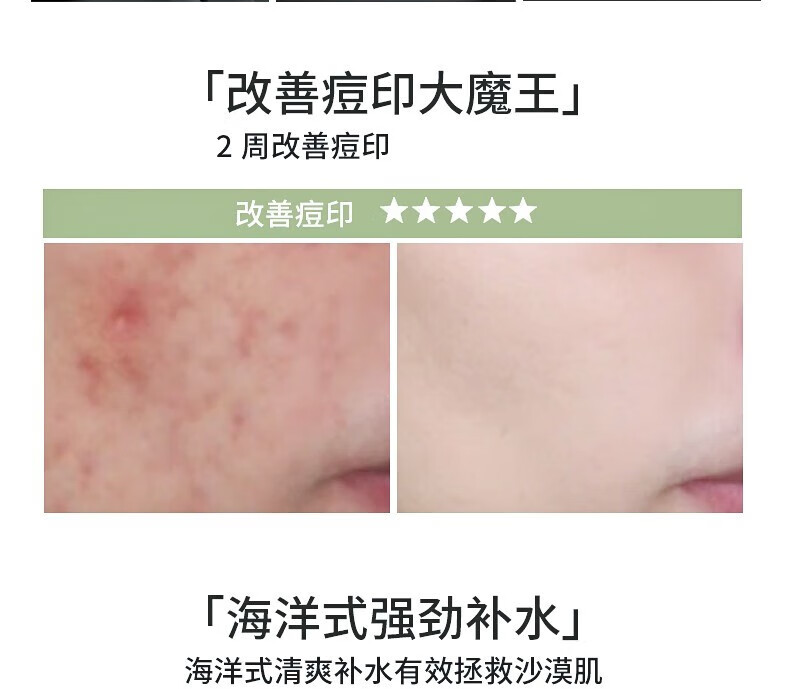 Tondi库拉索芦荟胶淡化逗印保湿补水舒缓晒后修护面霜凝胶男女士面部 300ml*两罐
