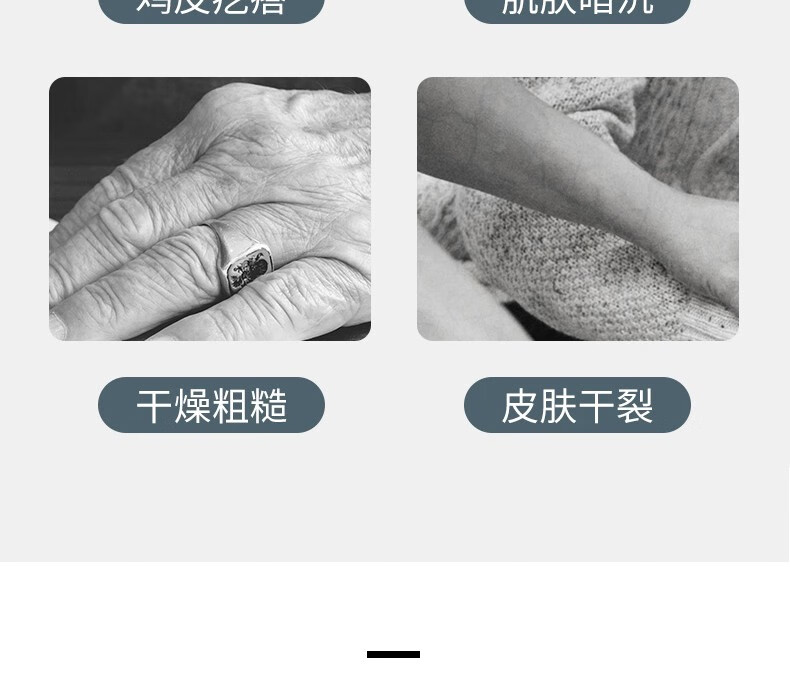 东半球 维生素E乳男女乳面霜保湿通用面霜补水护手保湿霜护肤乳滋润 经典维e乳(4瓶装）