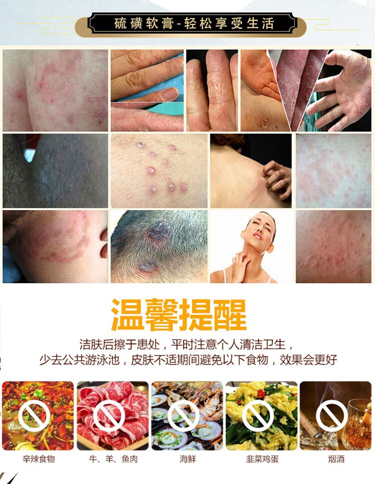 螨虫脂溢性头螨疥虫抑菌草本抑菌乳膏全身护理阴囊疥结节霜虱疥虫皮肤