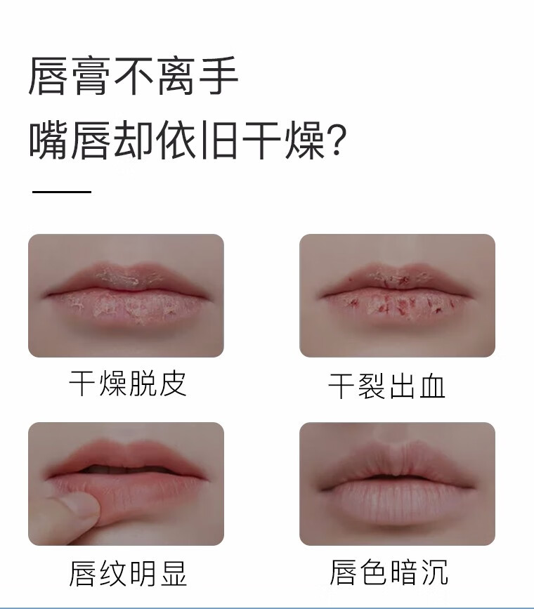 PLIFT唇部精华液 滋润补水保湿改善唇纹唇色打底唇膏液 唇部精华液 6ml