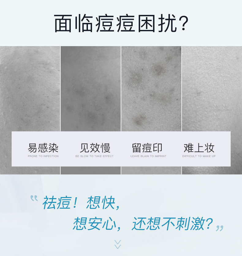欧利芙洋韩国olive young隐形痘痘贴青春痘贴吸脓遮痘印学生新手 【原味款】升级款102贴