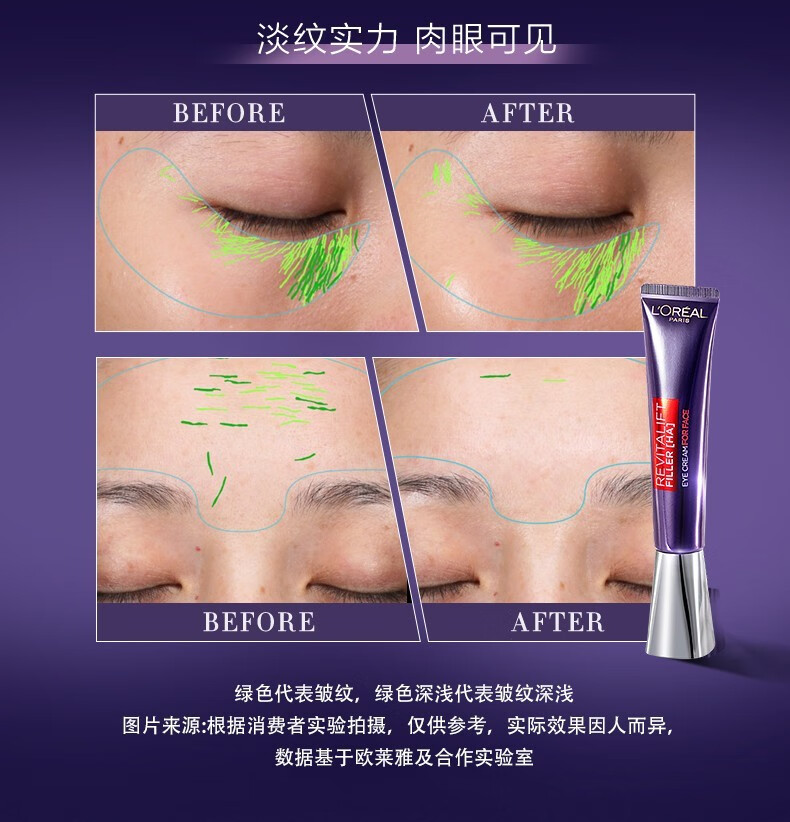 欧莱雅（LOREAL） 紫熨斗眼霜30ml复颜玻尿酸水光充盈全脸淡纹生日礼物送女友 单支装【明星单品】