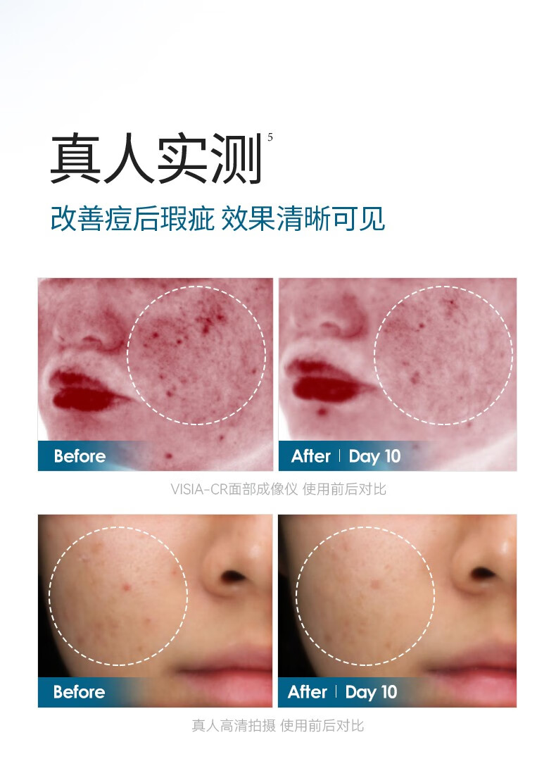 肌漾（SKINO） SKINO肌漾修印精华舒缓修护烟酰胺提亮肤色改善痘肌淡化红黑痘印 SKINO肌漾修印精华 30ml