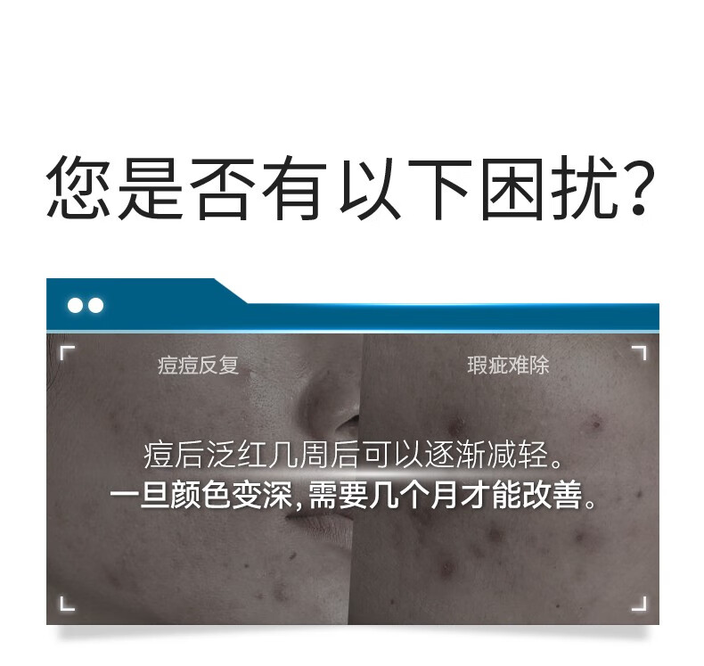 肌漾（SKINO） SKINO肌漾修印精华舒缓修护烟酰胺提亮肤色改善痘肌淡化红黑痘印 SKINO肌漾修印精华 30ml