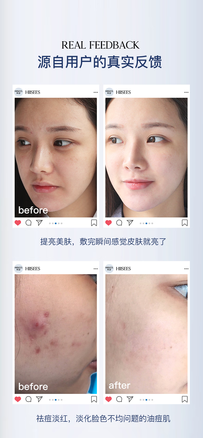 韩瑟效修护舒缓紧颜补水保湿面膜敏感肌可用