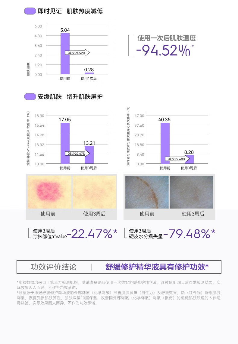 德妃（DERMAFIRM）紫苏舒缓修护精华液女面部精华保湿小安瓶 德妃紫苏精华新款