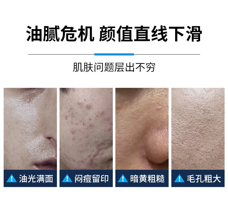 选派pai男士水乳套装油痘肌面部护肤三件套控油净痘补水保湿清爽 选派蓝色劲爽洁面乳100g 好评联系客服