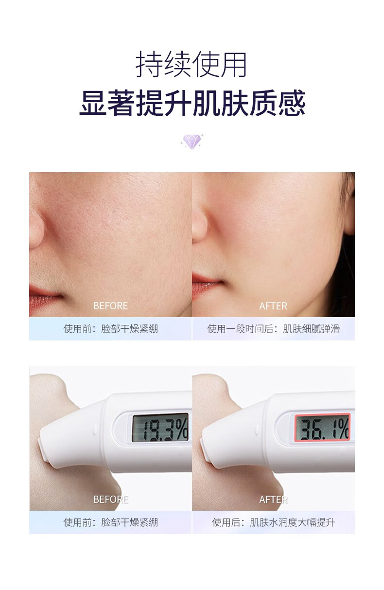 肌琳莎烟酰胺补水套装护肤品流光闪耀烟酰胺润泽保湿七件套男女 七件套