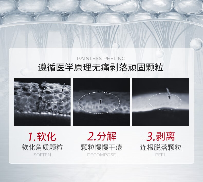 ning进口眼部精华液淡化脂肪汗管粒精华液紧致温和去油脂粒眼周女专用 【轻度脂肪粒适用】30ml