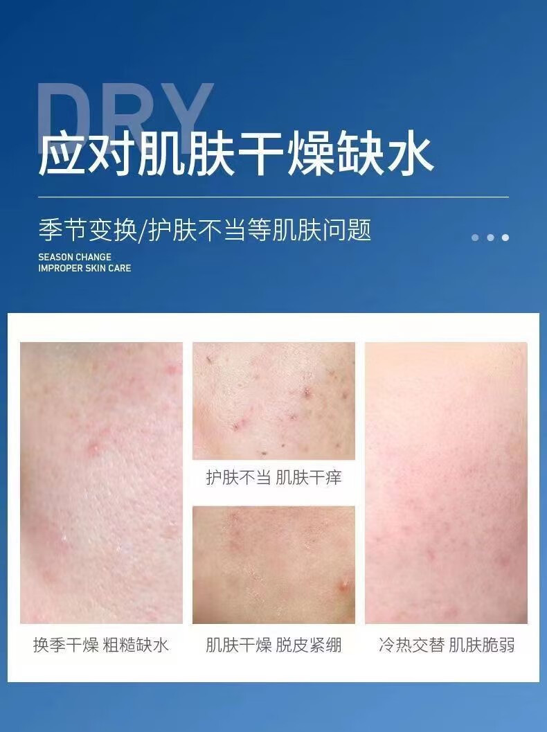 形象美凡士林补水润泽改善肌肤干燥护肤化妆品面部护理男女秋冬护肤面霜 凡士林保湿霜170g