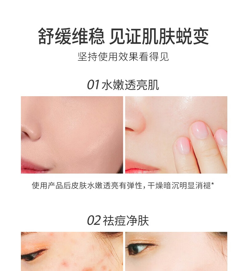 韩瑟（HIISEES）玻尿酸补水保湿精华液面部精华30ml