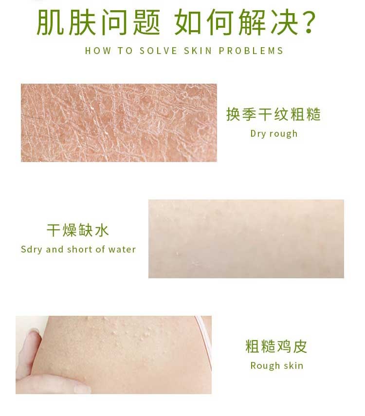 精心 止痒乳硅霜 维生素E乳保湿滋润身体乳冬天皮肤痒防干燥 皮肤痒干 【精心硅霜280g】