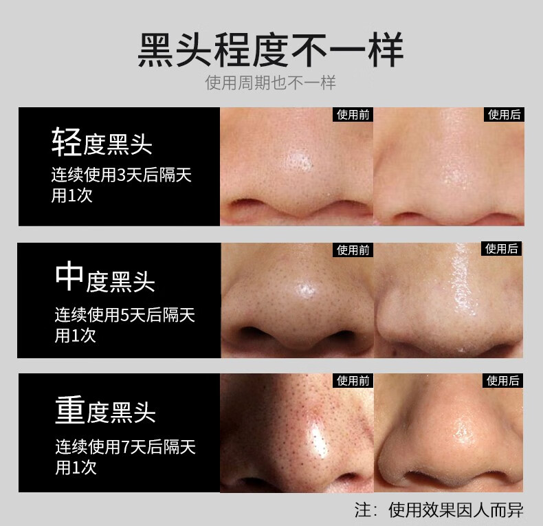 波斯顿男士专用鼻贴纸吸去黑头粉刺深层清洁收缩毛孔撕拉式鼻贴膜 去黑头鼻贴15片/盒