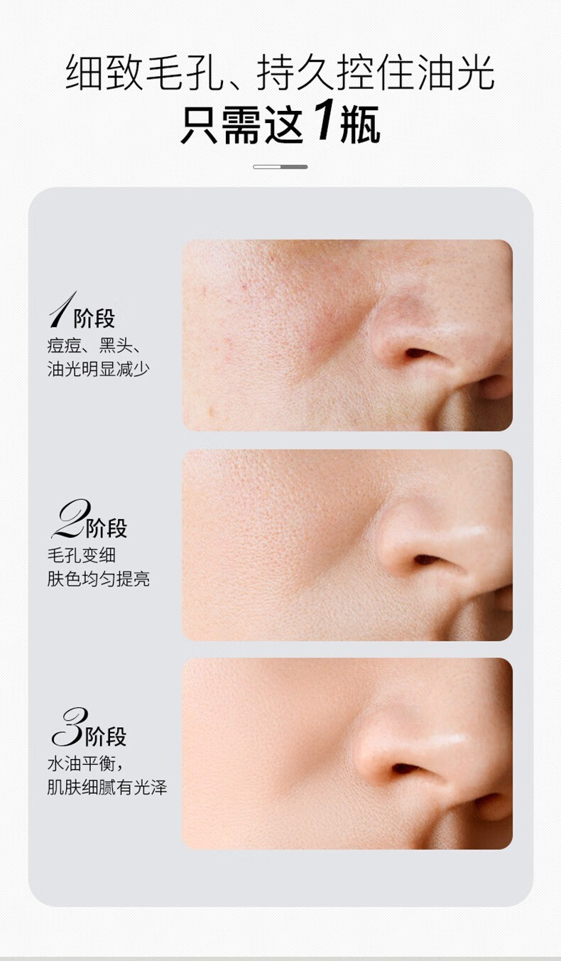 芷豆茶树净透绿茶泥膜清洁面膜深层补水去黑头粉刺收缩毛孔 泥膜100g[体验装]