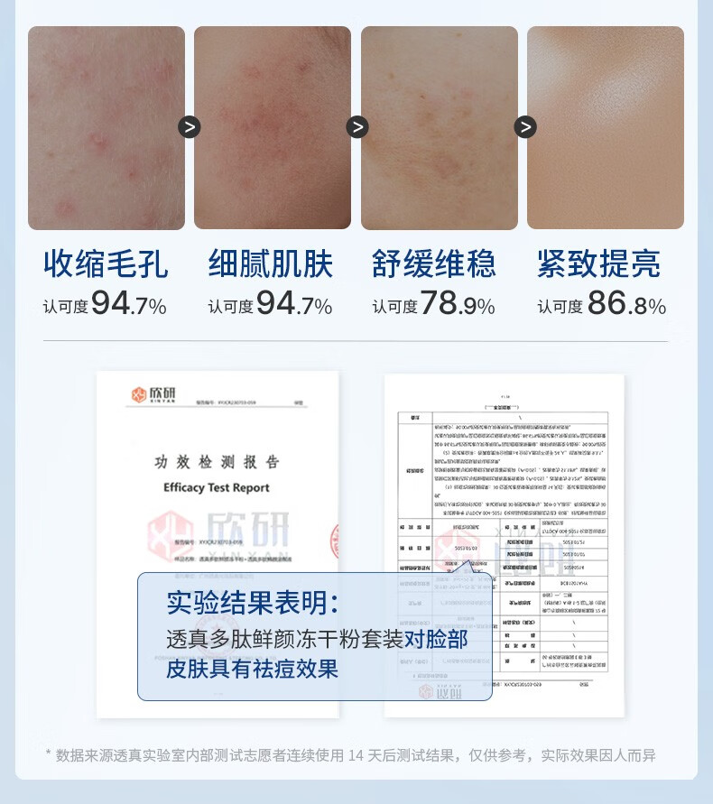 透真（LUCENBASE）多肽冻干粉精华液祛痘印痘坑寡肽修护收缩毛孔护肤套装送礼物女 【淡痘修护】多肽冻干粉50瓶