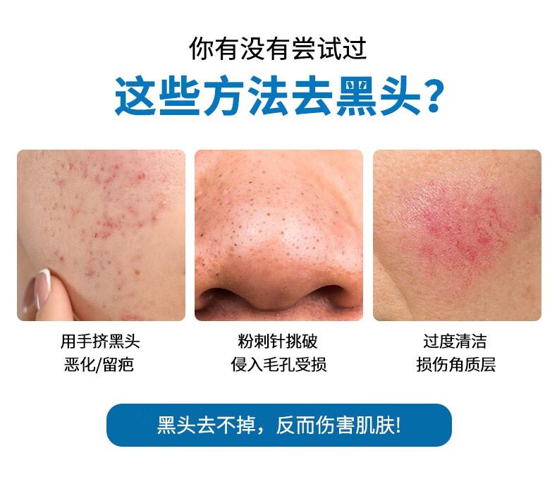 海洋主义（Socus） 去黑头收缩毛孔鼻贴清洁男女士专用T区护理黑头导出液 20片