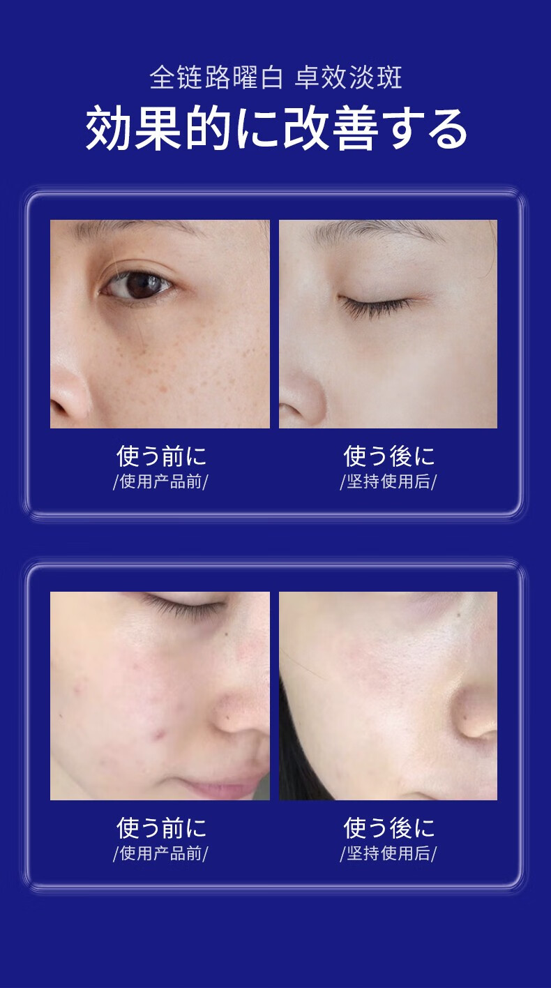 UCM肤研美白祛斑精华液提亮收缩毛孔控油女学生原液补水