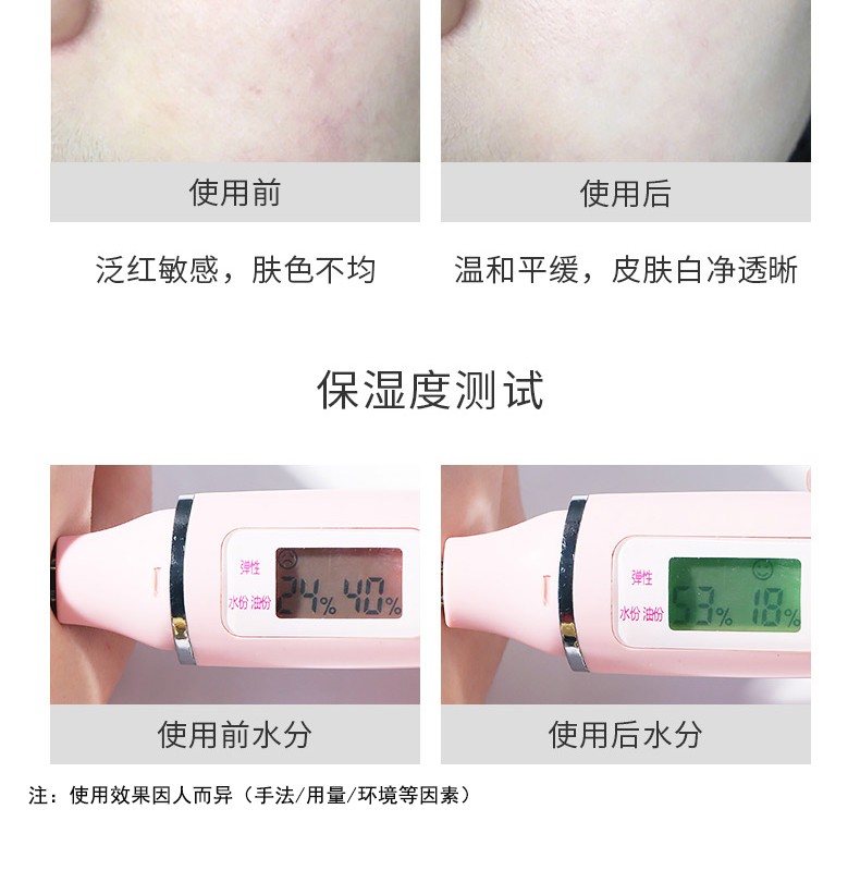 AHC紫苏水乳套装护肤品爽肤控油保湿补水送男女友情人节礼物礼盒 AHC紫苏水乳礼盒套装