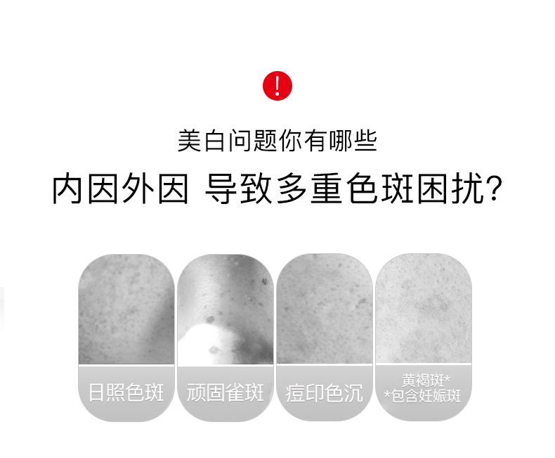 韩束（KanS）精华液美白提亮肤色紧致淡化细纹补水保湿烟酰胺护肤品 【美白提亮】臻白精华液30ml