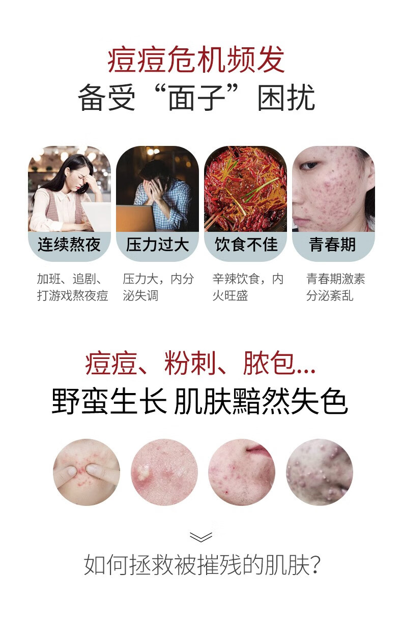 美洳活性肽祛痘精华去祛痘印痘疤膏淡化痘坑修复凹洞青春痘男女士学生 三瓶周期装 升级款