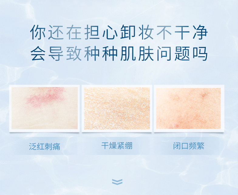 卓沿（SKIN ADVANCED）【 屈臣氏】S.A.卓沿白金舒润净颜修护卸妆膏 全新上市敏肌适用 80g