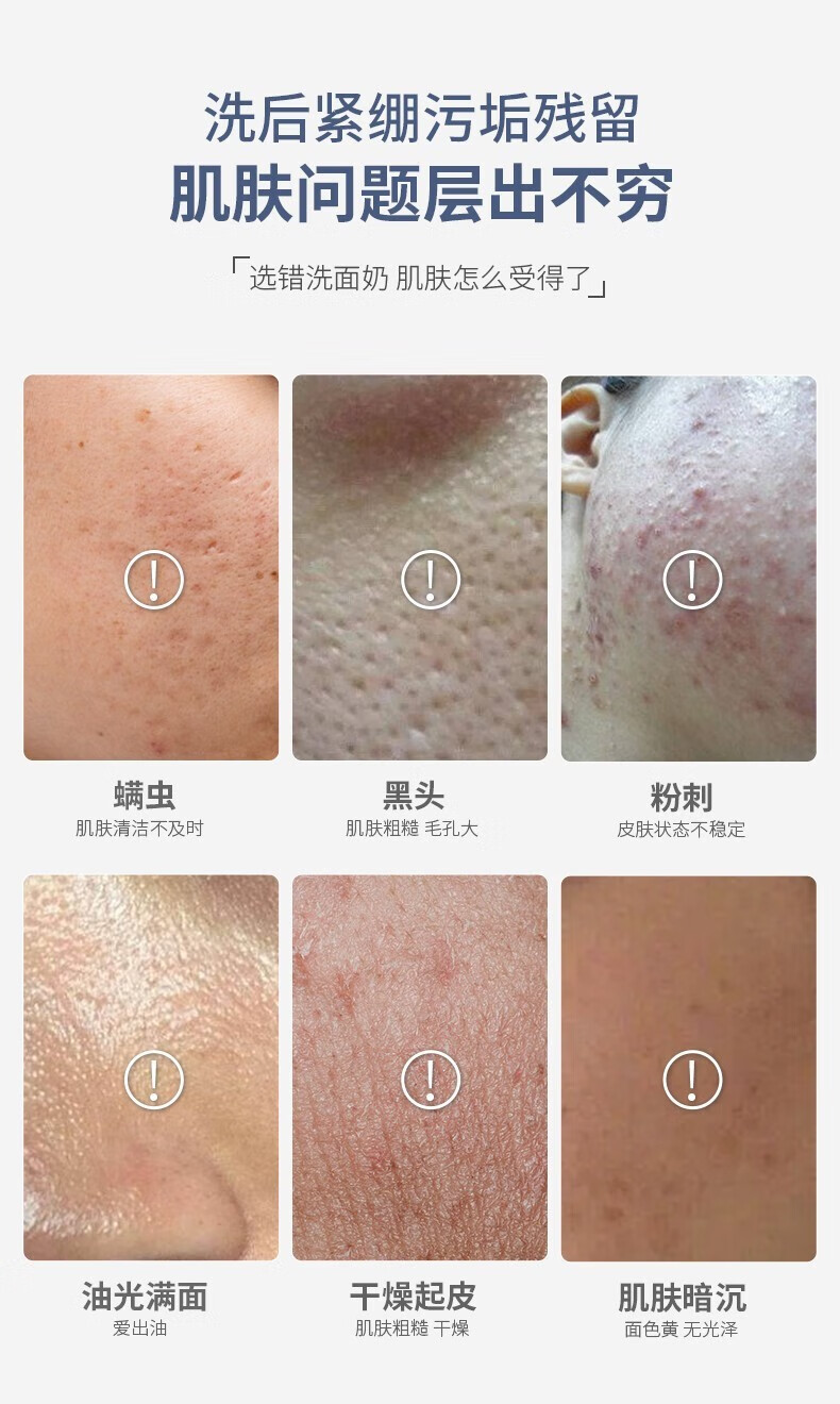 臻元臻元洗面奶氨基酸洁面乳男女清洁黑头甄源瑧园深层清洁毛孔 洗面奶*2