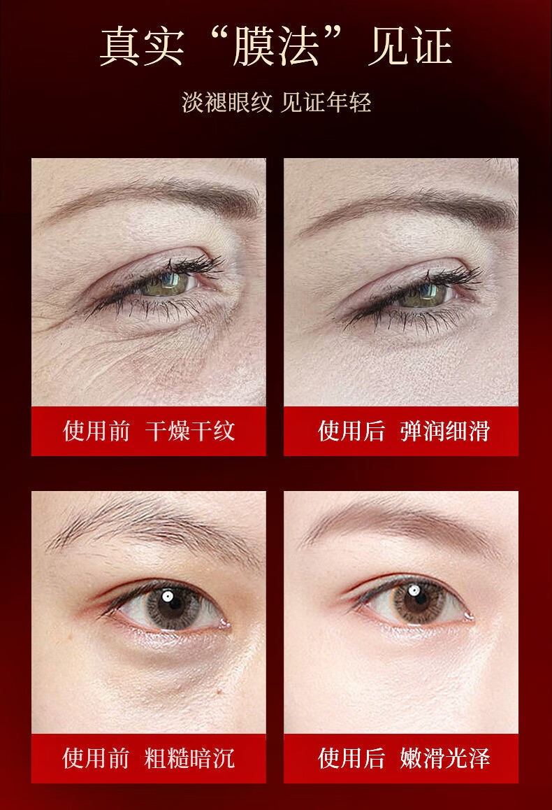 韩伦美羽黄金蜂窝御龄蝴蝶眼膜女眼纹法令纹鱼尾纹眼袋黑眼圈保湿补水肌活 （推荐）4盒20片黄金蝴蝶眼膜