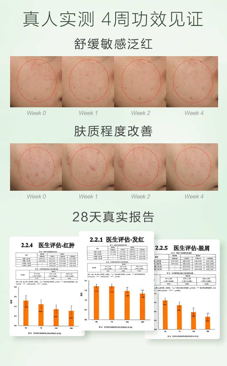 养生堂（YOSEIDO） 养生堂时空弹御龄精华露补水保湿平衡水油修护淡纹面部抗皱紧致精华液修护抗氧化 控油精华露7支装（油痘肌适用）