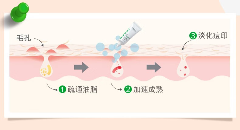 宝拉珍选（Paula's Choice）面部精华系列 控油改善黑头去角质改善毛孔面部精华男女 【油痘黑头】水杨酸精华液30ml