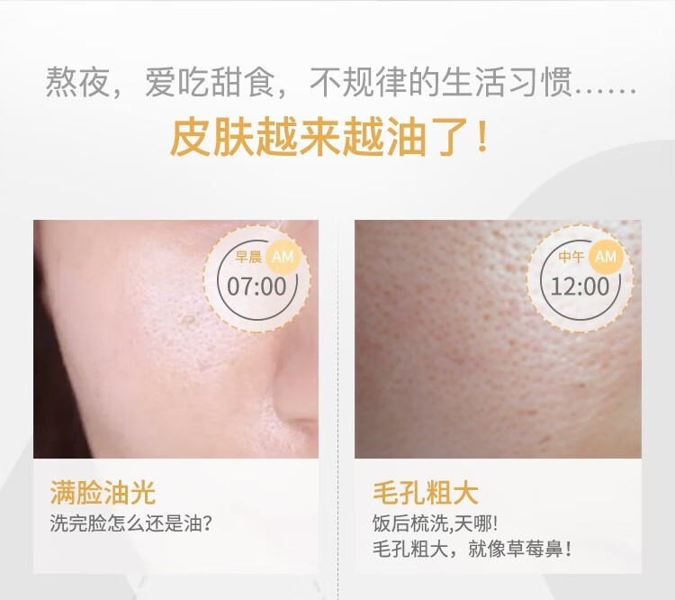 934 酵母控油套装水乳补水收敛毛孔（直播专属） 酵母水＋酵母露