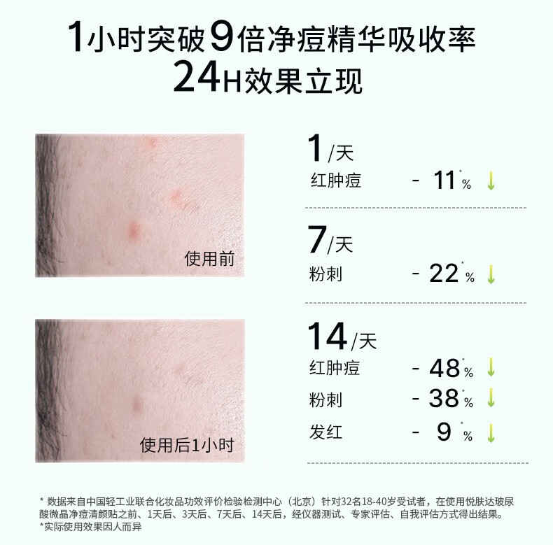 悦肤达（Reveda）痘痘贴小痘钉玻尿酸芙微晶净痘清颜贴祛痘贴小豆丁隐形固态精华 6片装（62mg/片）