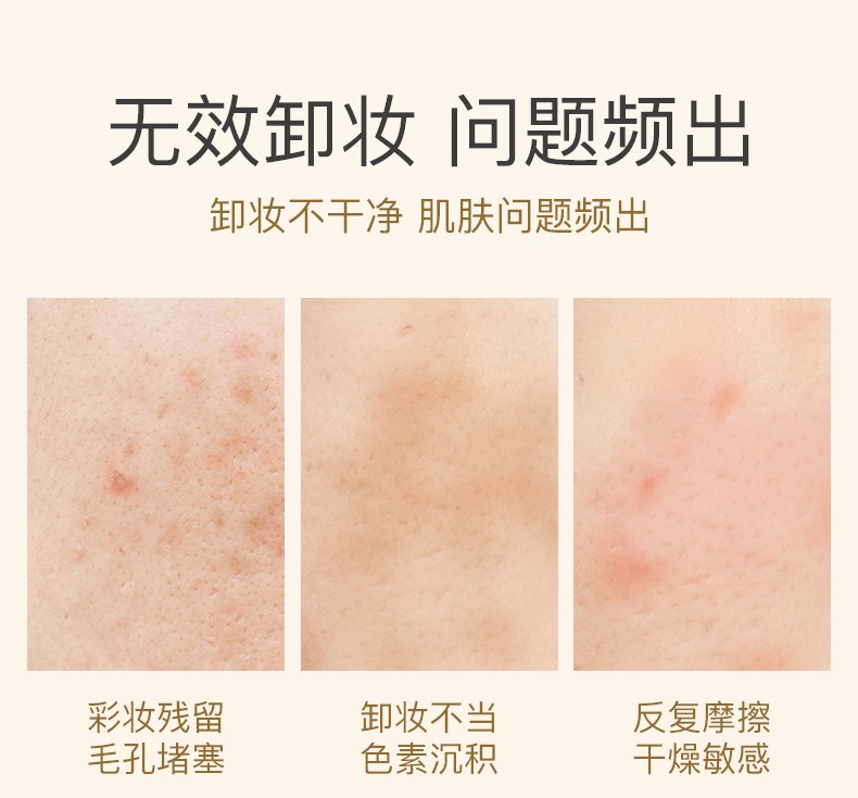 韩美臣卸妆水150ml 眼唇脸三合一卸妆油乳膏液温和清洁 保湿舒缓一抹即净清洁毛孔不油腻不刺激敏感肌 卸妆水150mlX2瓶