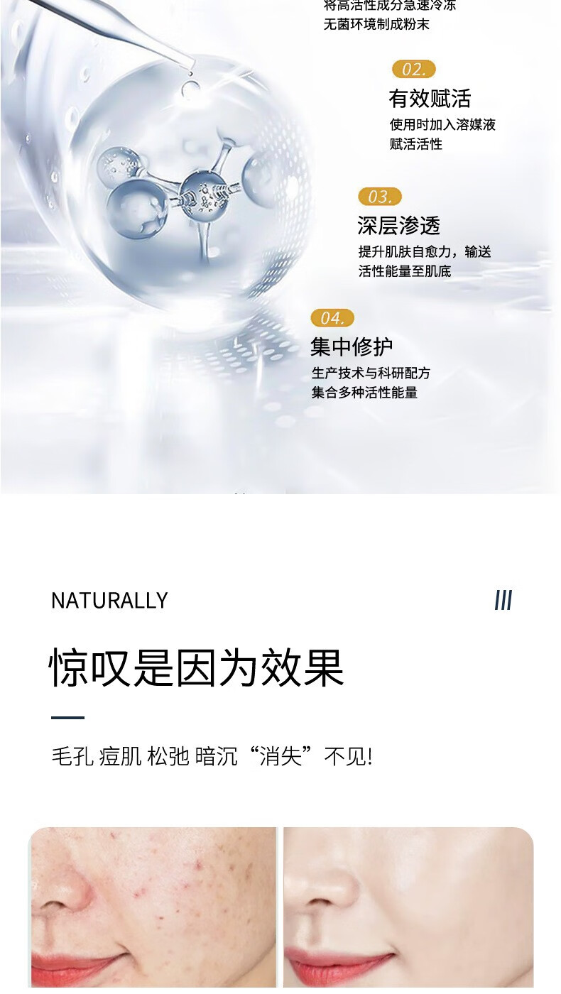 琦憶琦憶海绵微晶i针冻干套盒 小绿膜植物焕肤微晶 美容院专业用同款 一盒装海绵微晶