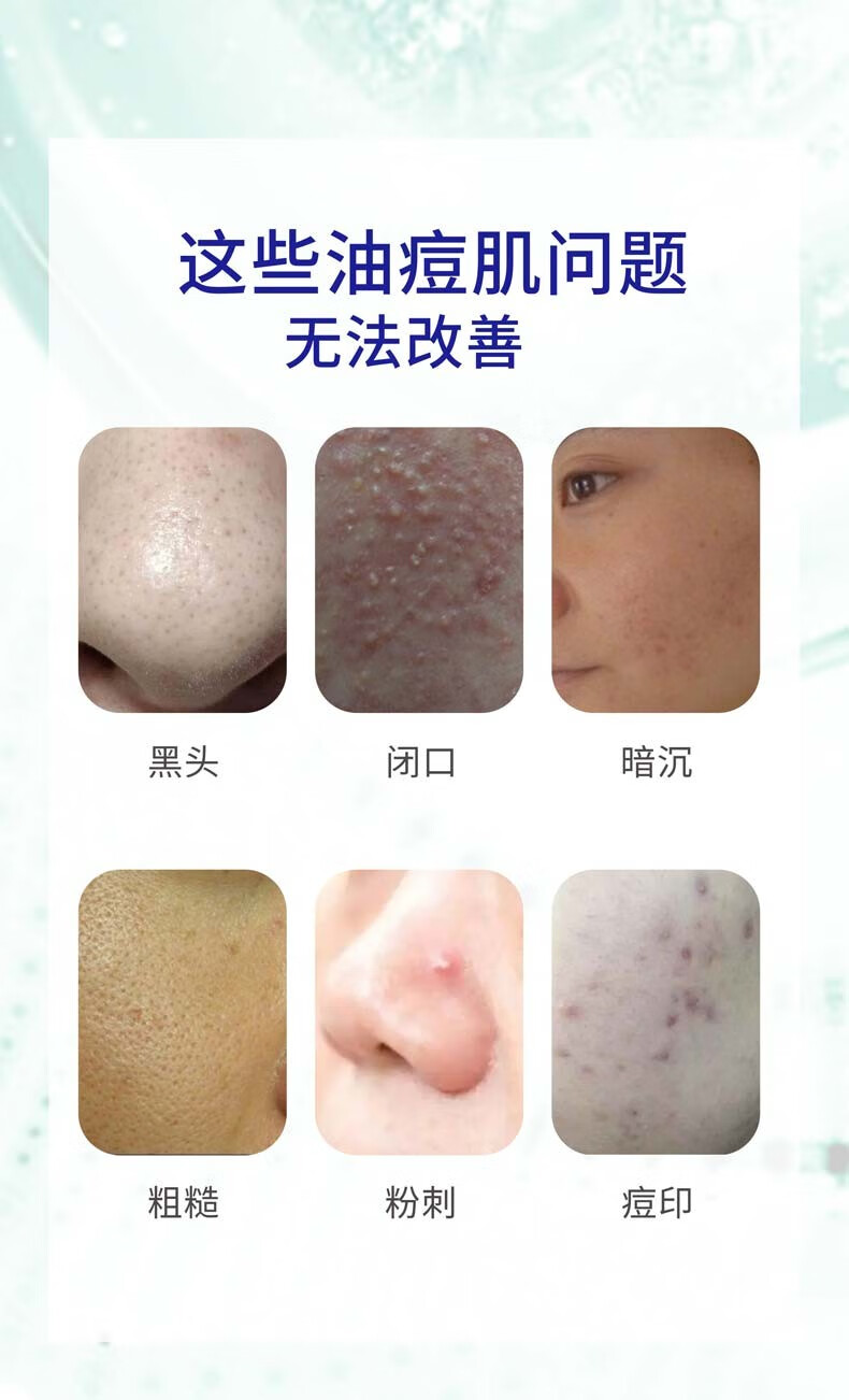 依赛芙（YISAIFU）水杨酸清痘控油面膜100g