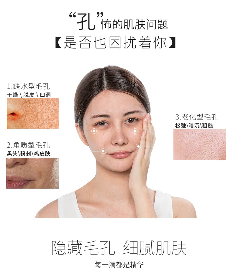 军博仕德方毛孔细嫩乳100ml 收敛肌肤 军博士 补水保湿 修护毛孔精华乳