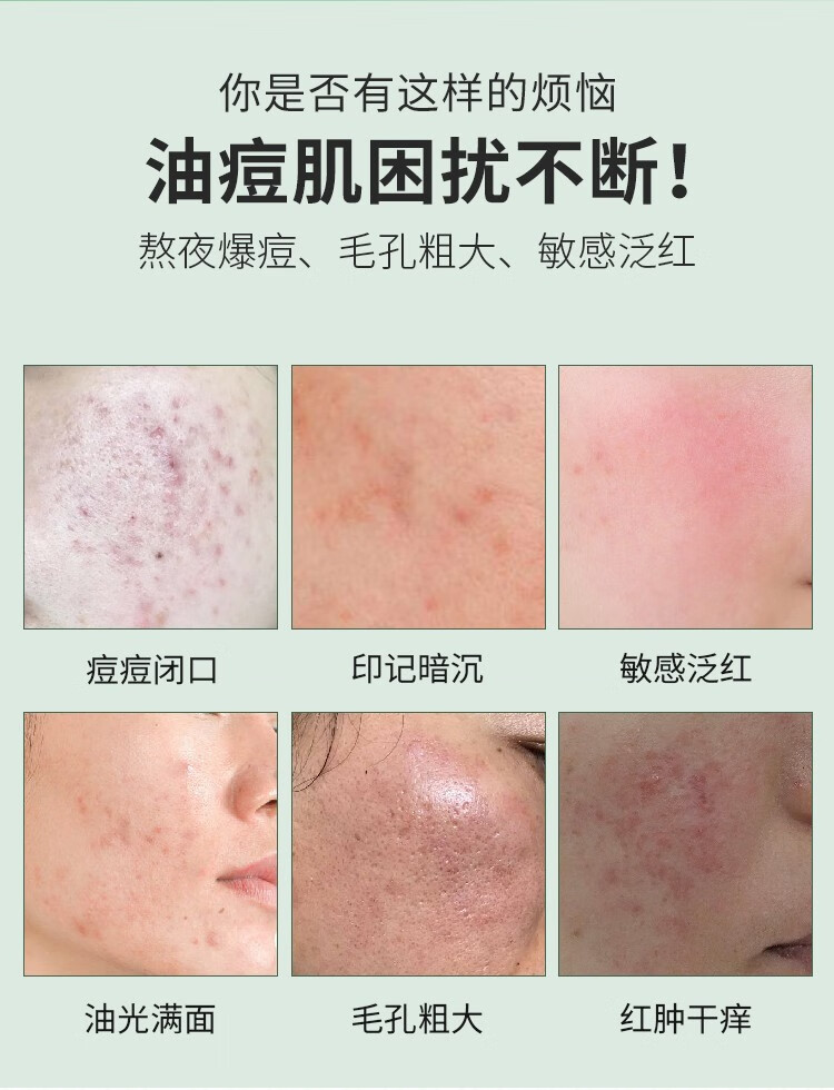 初源漾清肌纯美白净痘啫喱小绿瓶男女通用美白光洁柔滑肌肤 净痘啫喱 1瓶