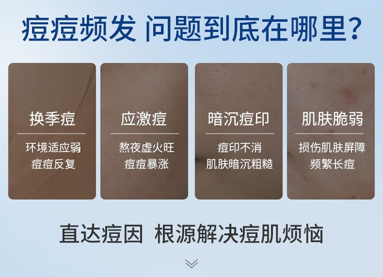 透真（LUCENBASE）多肽冻干粉精华液祛痘印痘坑寡肽修护收缩毛孔护肤套装送礼物女 【淡痘修护】多肽冻干粉50瓶