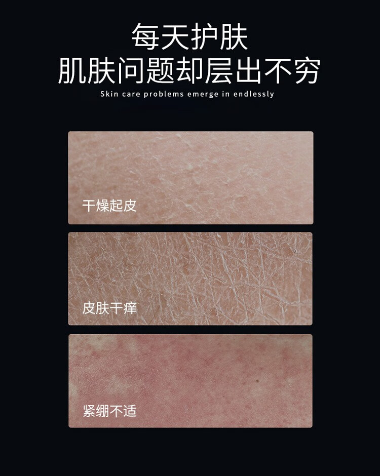 欧莱雅水凝露男士高保湿补水面部护肤爽肤水男水油平衡青少年 水凝露50*5瓶（共250ml）