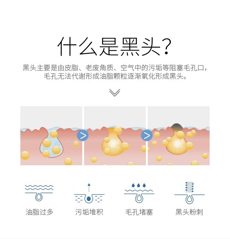 遇见香芬果酸毛孔清洁液清洁黑头粉刺舒润毛孔鼻贴 【清洁鼻头】100ml