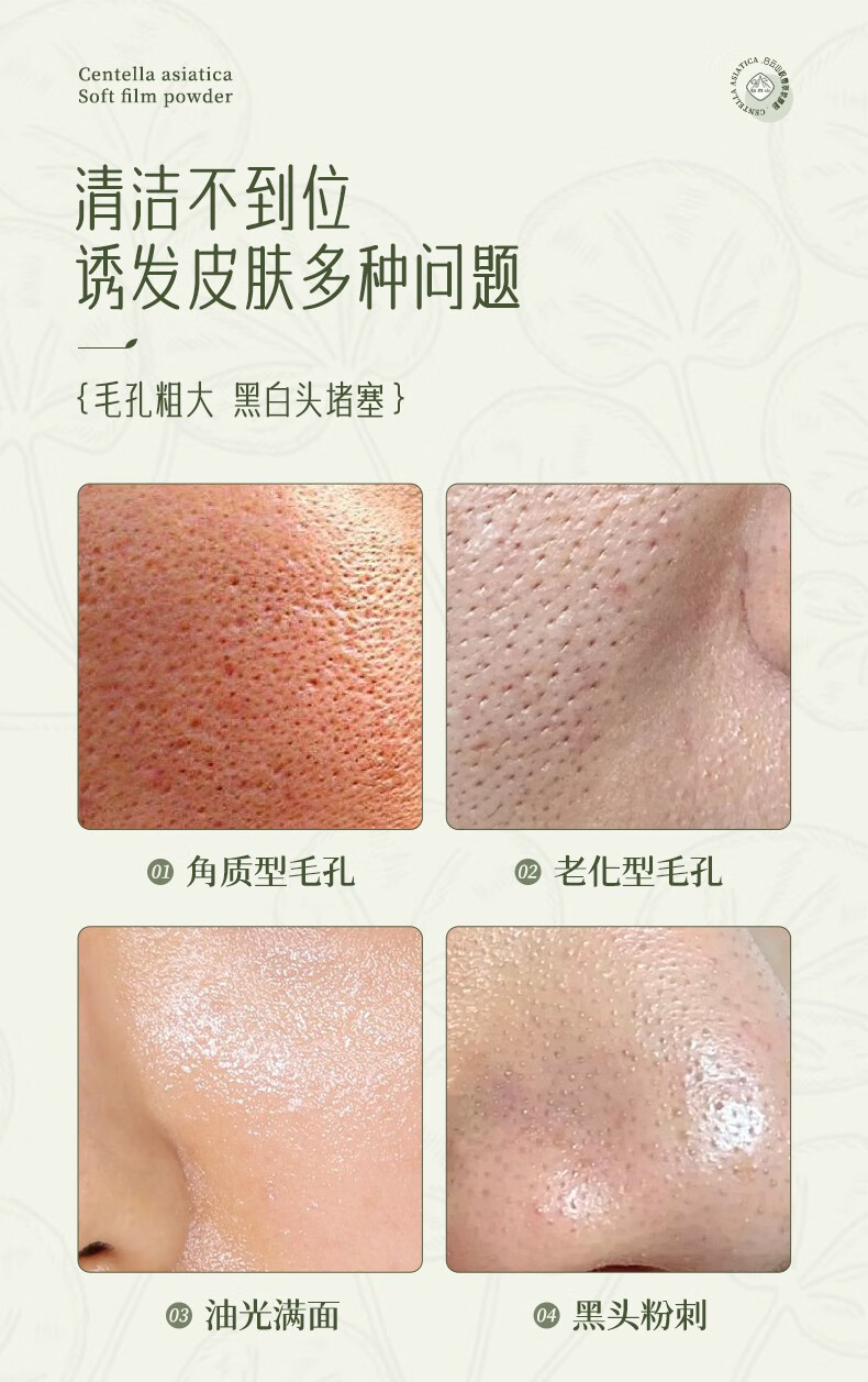白云山积雪草软膜涂抹面膜粉收缩毛孔淡粉刺闭口减黄黑暗沉紧致补水男女 1袋 500g 轻度毛孔适用